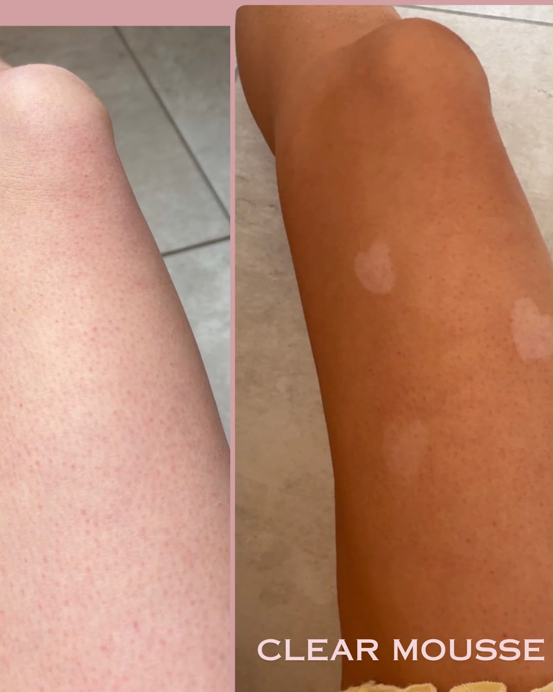 SUNORA Self-Tanning Mousse Clear | Melon Scent
